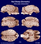 Whole brain image