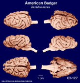 Whole brain image