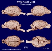 Whole brain image