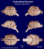 Whole brain image