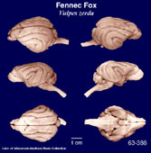 Whole brain image