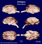 Whole brain image