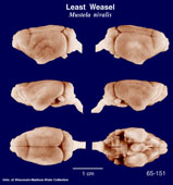 Whole brain image