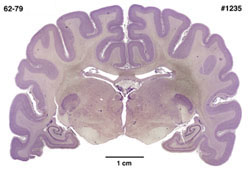 Brain section image