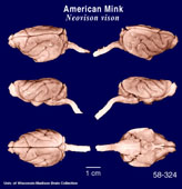 Whole brain image
