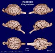 Whole brain image