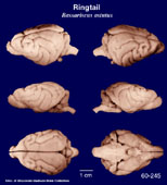 Whole brain image