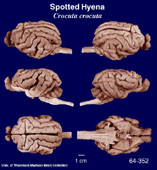 Whole brain image