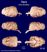 Whole brain image