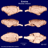 Whole brain image
