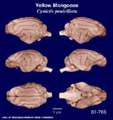 Whole brain image