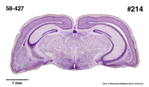 Brain section image