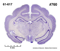 Brain section image