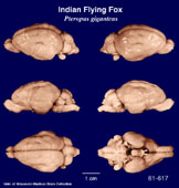Whole brain image