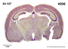 Brain section image
