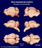 Whole brain image