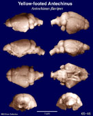 Whole brain image