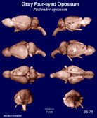 Whole brain image