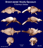 Whole brain image
