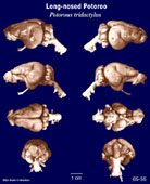 Whole brain image