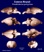 Whole brain image