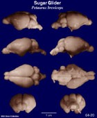 Whole brain image