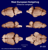 Whole brain image