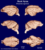 Whole brain image