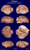 Whole brain image