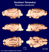 Whole brain image