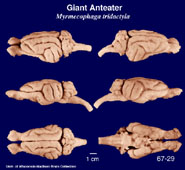 Whole brain image