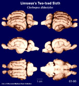 Whole brain image