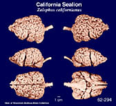 Whole brain image