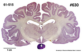 Brain section image