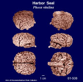 Whole brain image