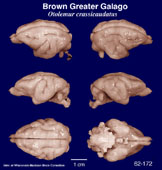Whole brain image