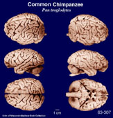 Whole brain image