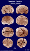 Whole brain image