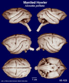 Whole brain image