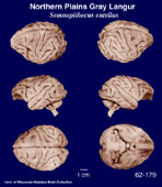 Whole brain image