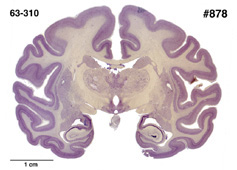 Brain section image