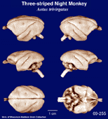Whole brain image