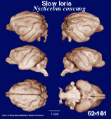 Whole brain image