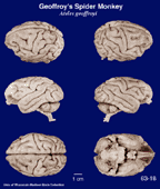 Whole brain image