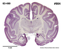Brain section image