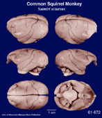 Whole brain image