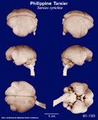 Whole brain image