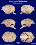 Whole brain image