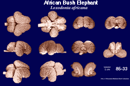 Whole brain image