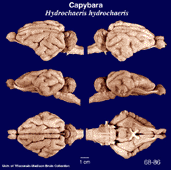 Whole brain image